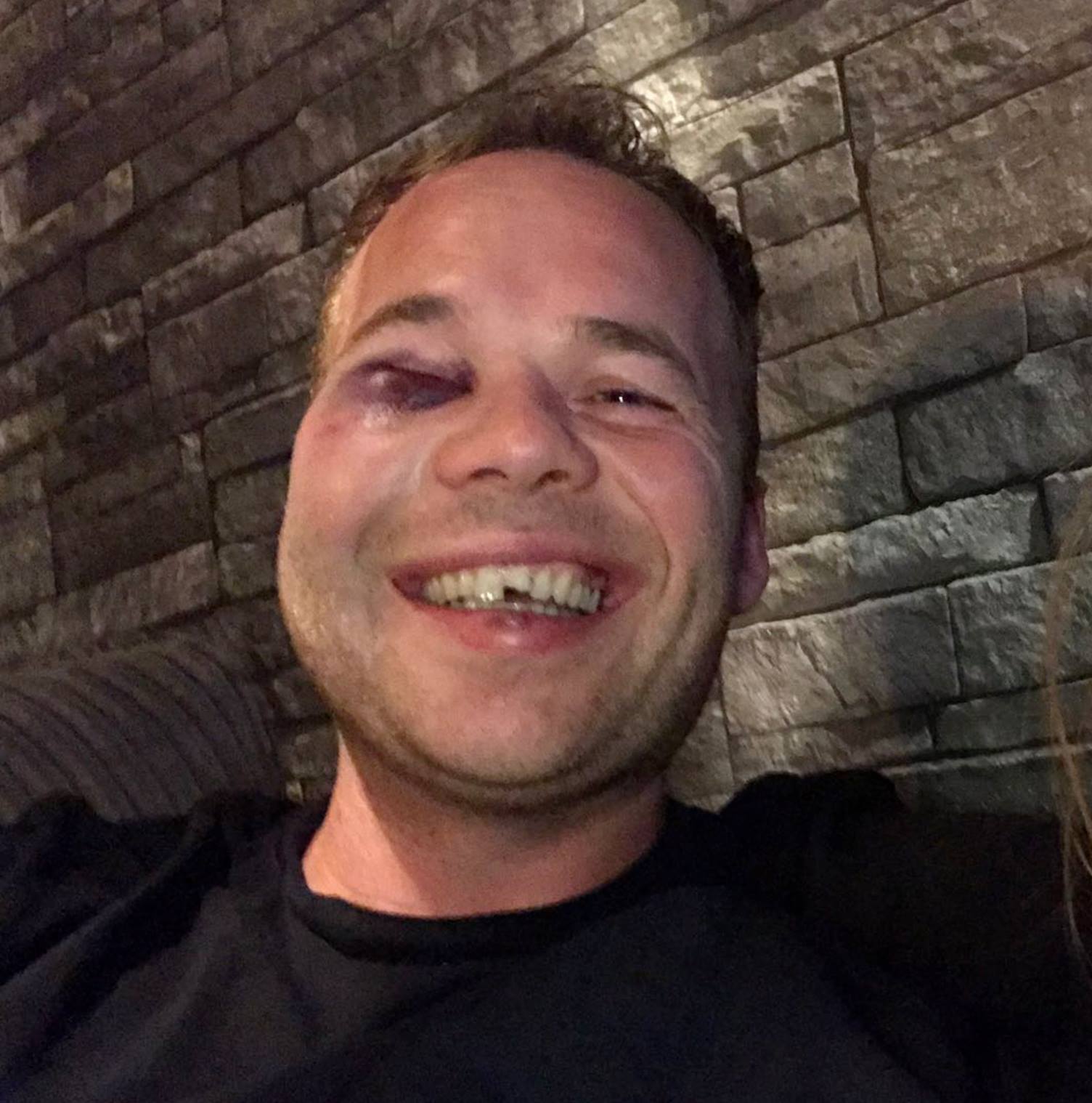 Groninger in elkaar geslagen op straat in Amsterdam, slachtoffer roept  daders op zich te melden | WNL, image size:1504x1518